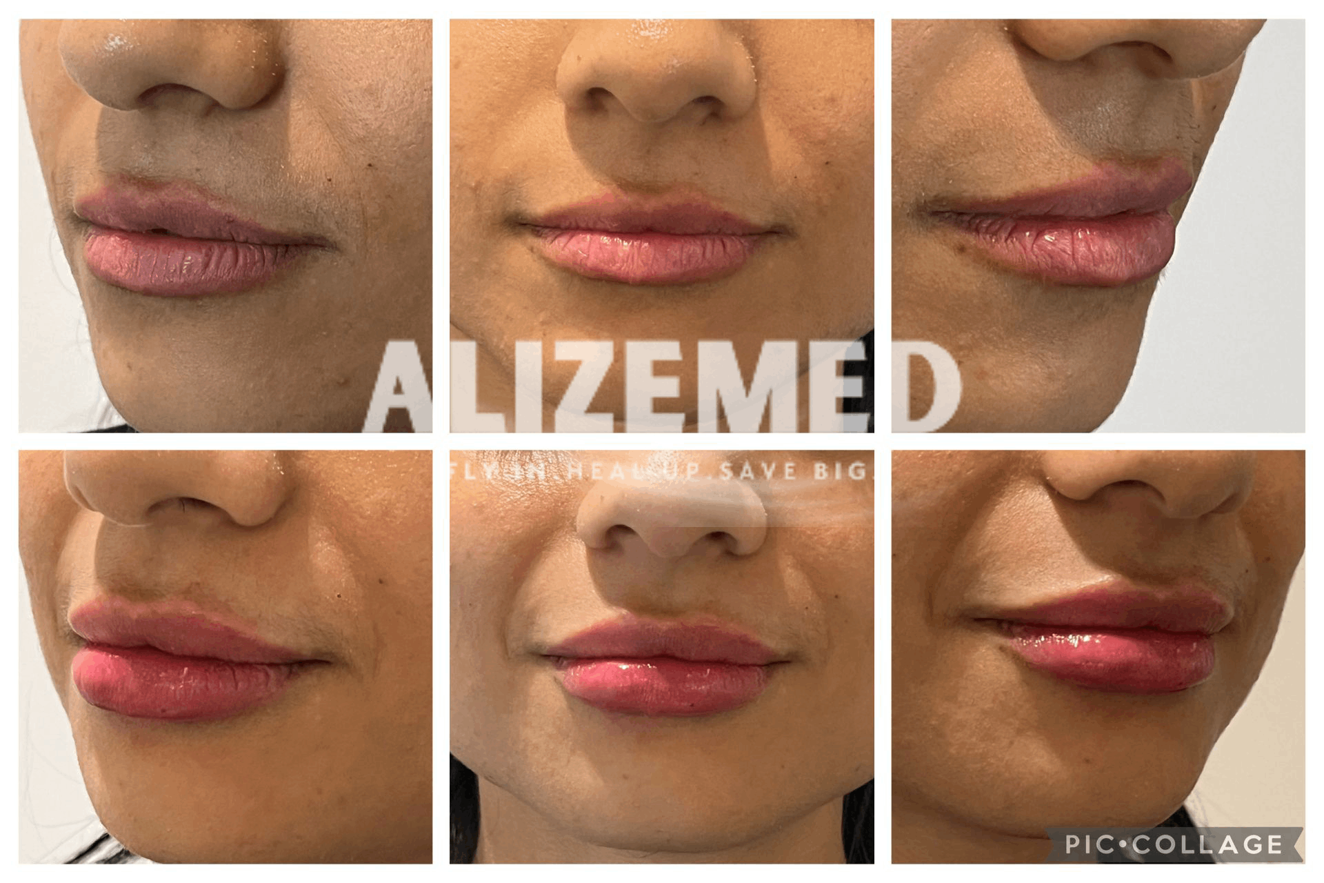 Alizemed Health Tourism Alizemed Health Tourism